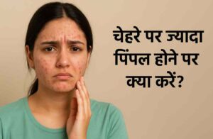 पिम्पल हटाने का तरीका: रातोंरात पिंपल्स दूर करने का अचूक उपाय 3 पिम्पल हटाने का तरीका